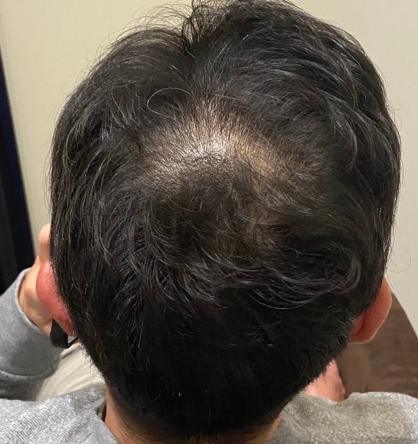 プログラム2ヵ月目