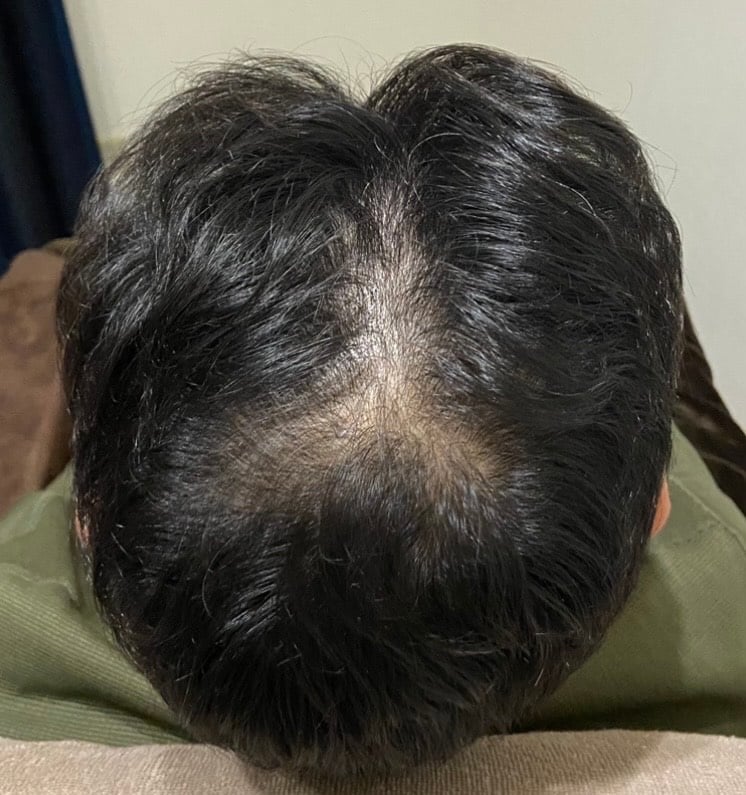 プログラムスタート前