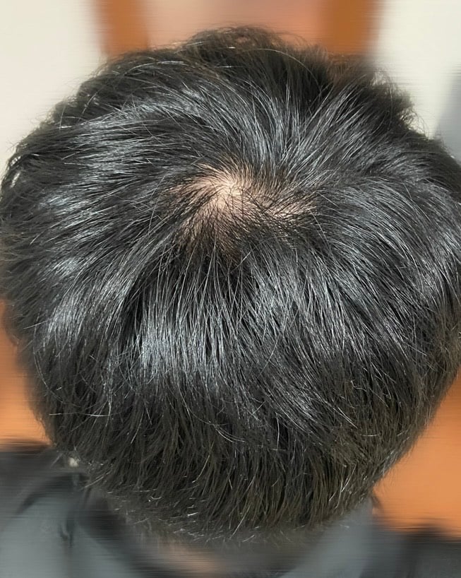 プログラムスタート前