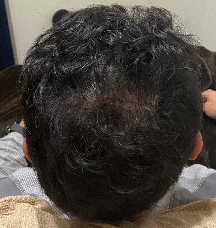 プログラム3ヵ月目