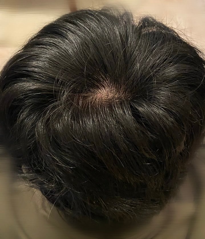 プログラム1ヵ月目