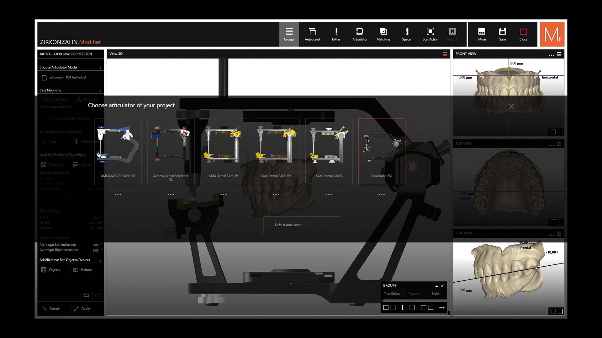 STEP 1 ジョーアライナーを使用するには、まずZirkonzahn.Modifierソフトウェアの「Model Maker」モジュールで使用する咬合器を選択します。