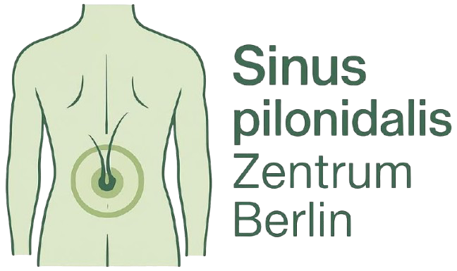 Sinus pilonidalis (Steißbeinfistel): Ursachen, Symptome, Behandlung & Tipps zur Vorbeugung