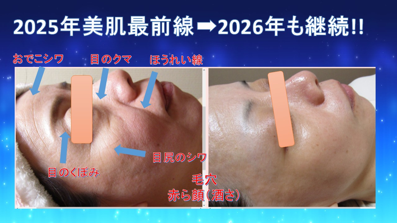 2025年美肌最前線➡2026年も継続!!