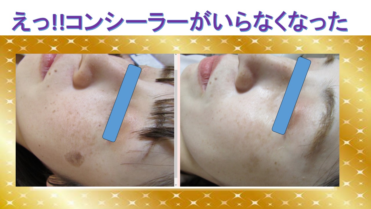 えっ!!コンシーラーいらなくなったかも～