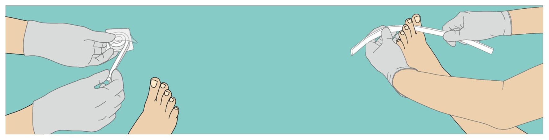 Ligasano weiss Wundputzer interdigital Anwendung