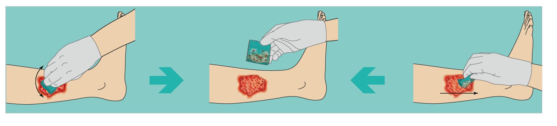 Ligasano grün Wundputzer Wischtechnik