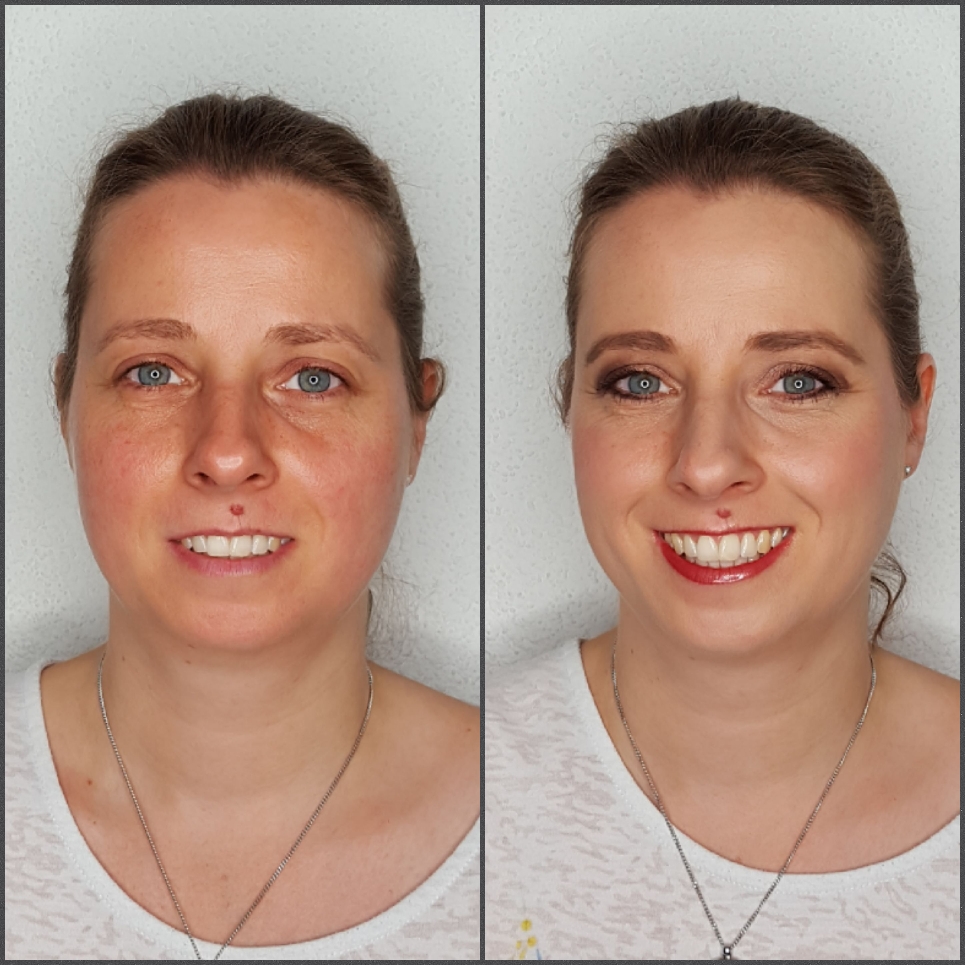 Vorher/Nachher Foto