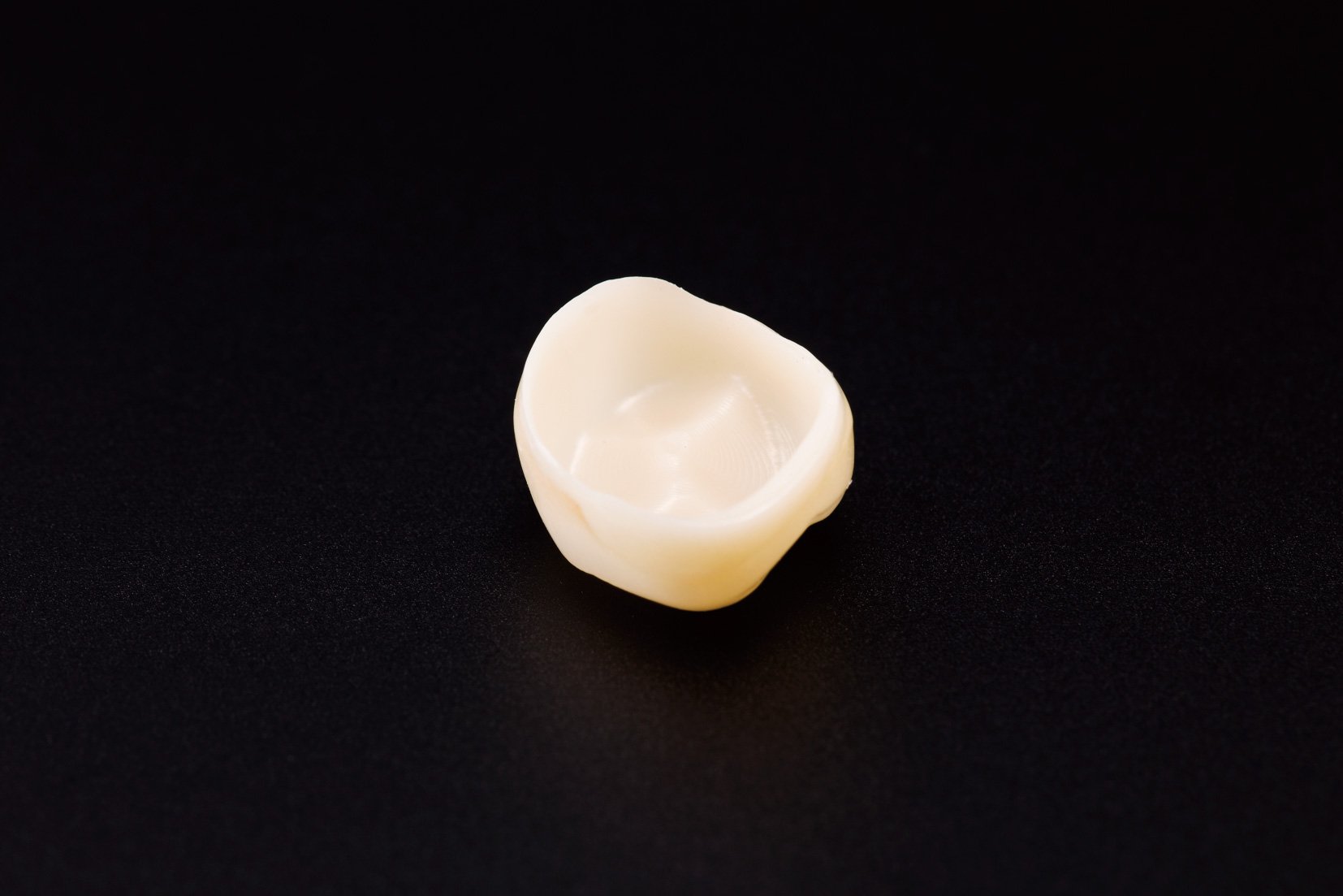 オールセラミックス