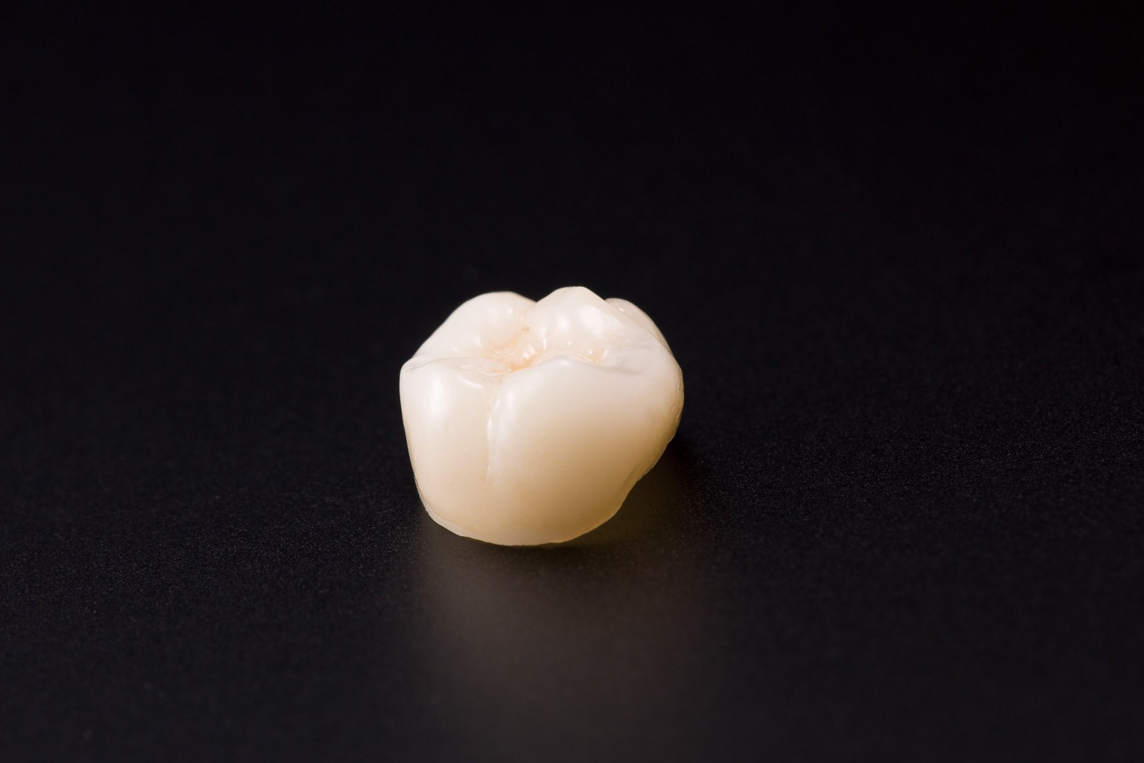 オールセラミックス