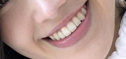 永井歯科医院 審美歯科