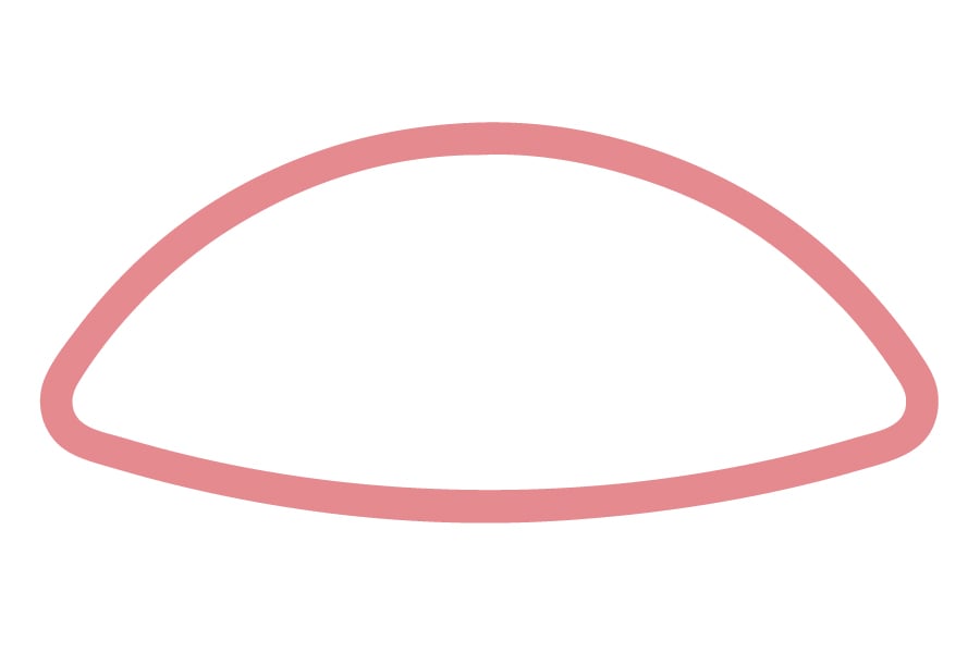 HKE - Halbkugel, innen bombiert 