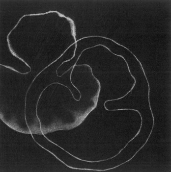 Schnittstellen 2001/2002 | Mezzotinto, Kupferplattenformat 12,5 x 12,5 cm, Blattgrösse 20 x 20 cm, Zerkall Bütten 300 g/m2