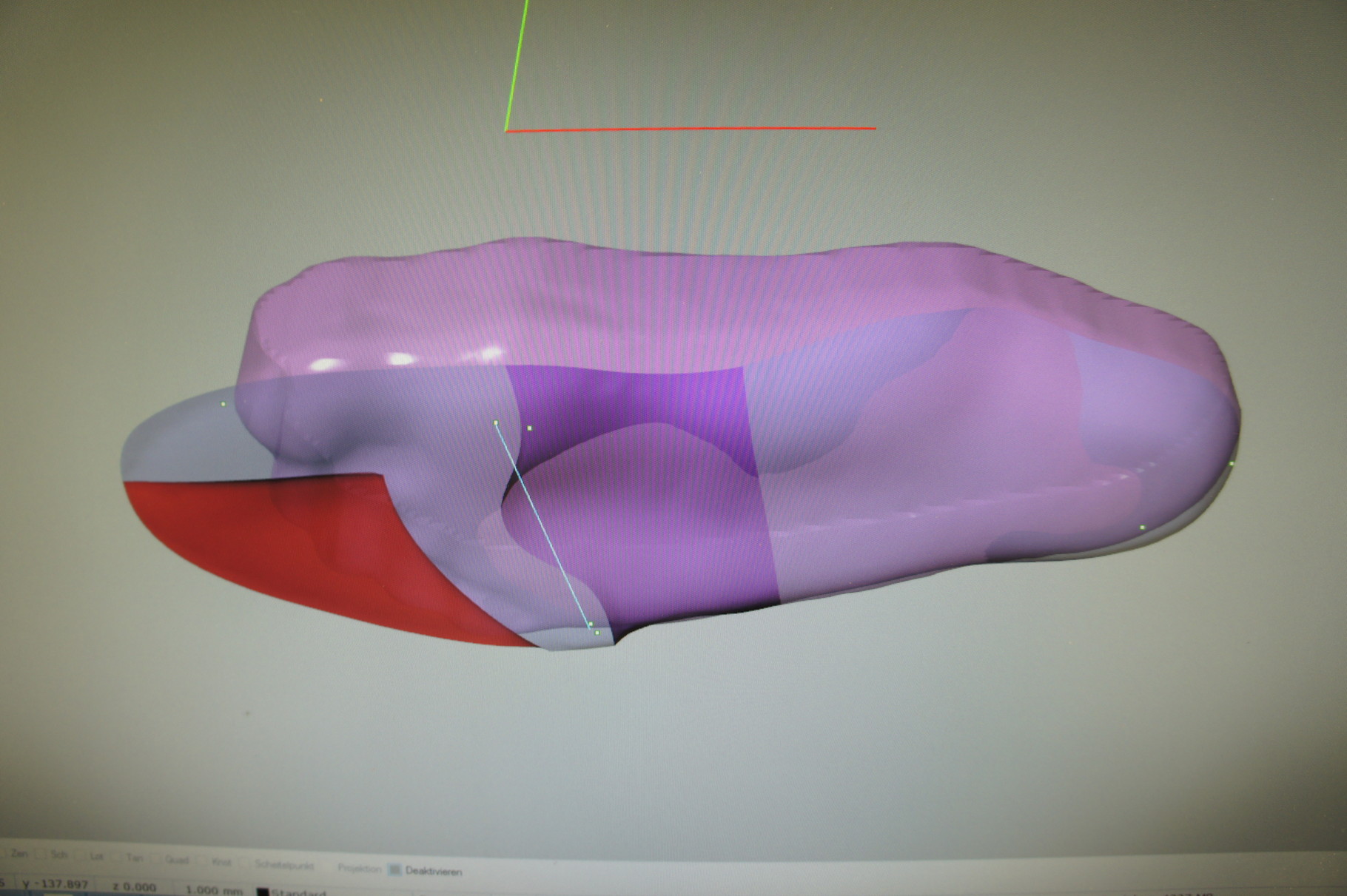 Anpassung propriozeptive Einlage