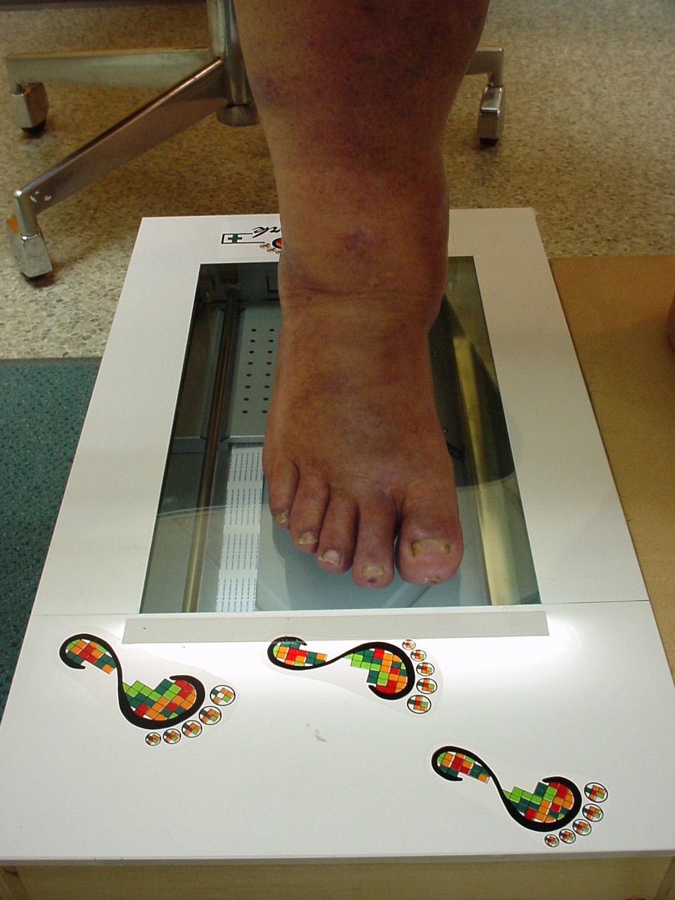 Problemlose Anfertigung einer Belasteten oder Unbelasteten Trittspur