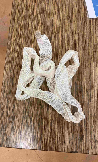 Schlangen wachsen lebenslang und müssen sich daher hin und wieder häuten.