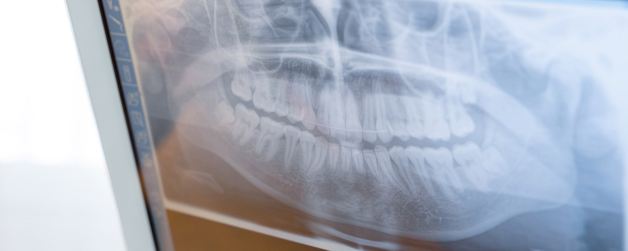  Digitales Röntgen / Mund- Kieferchirurgie, Gesichtschirurgie / Tagesklinik Dr. Beniashvili, Dr. Shavlokhova, Prof. Dr. Dr. Wangerin - is-fullwidth 