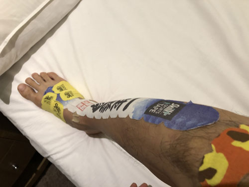 テープを脚に貼った画像