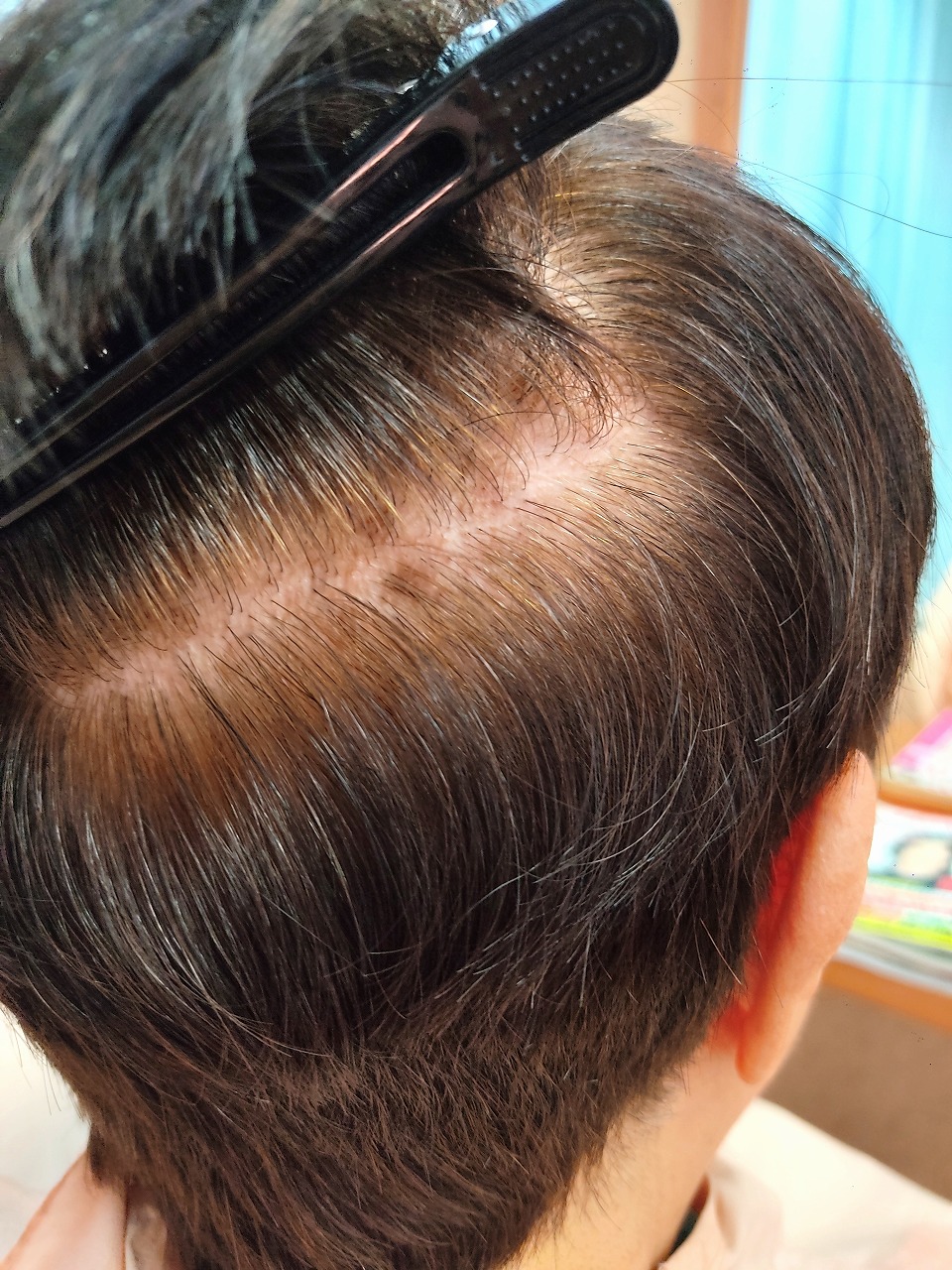 染める時、濡らすの？