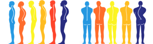 ドクターバンカイロプラクティック：姿勢　猫背