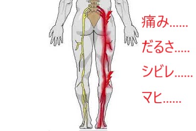 神経圧迫と症状の変化