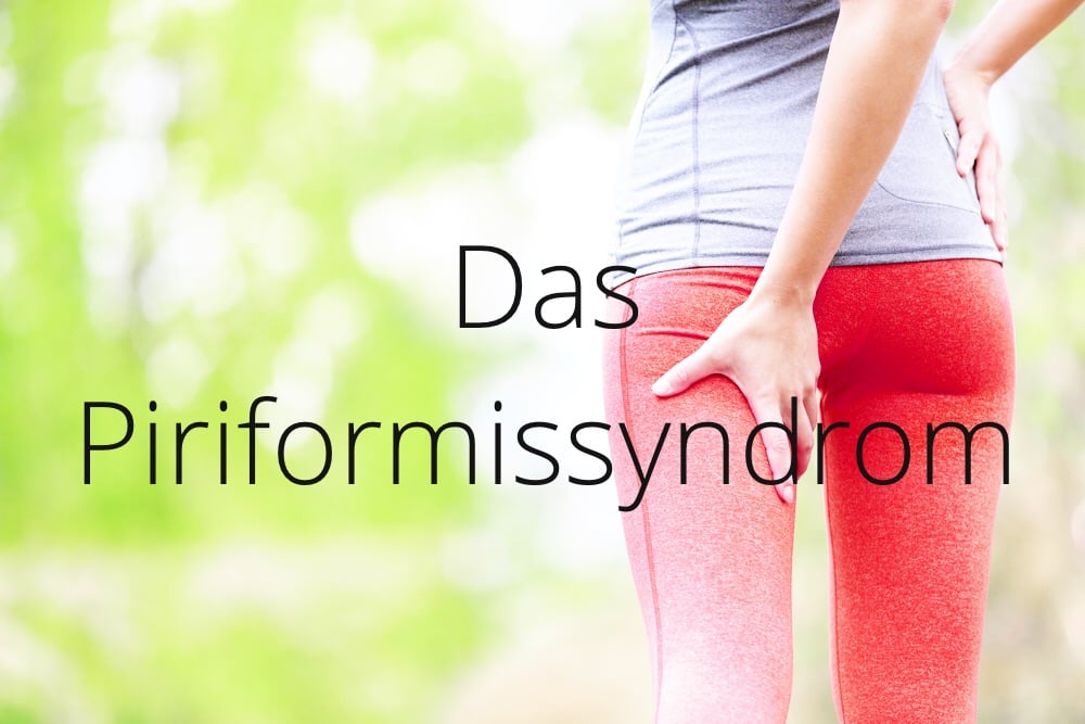 Aus der Praxis: das Piriformissyndrom