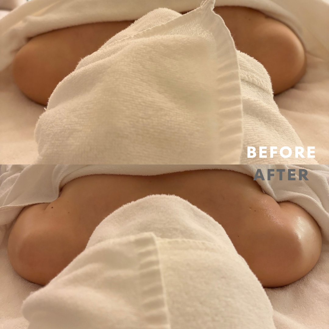 巻き肩リンパマッサージモニター②様