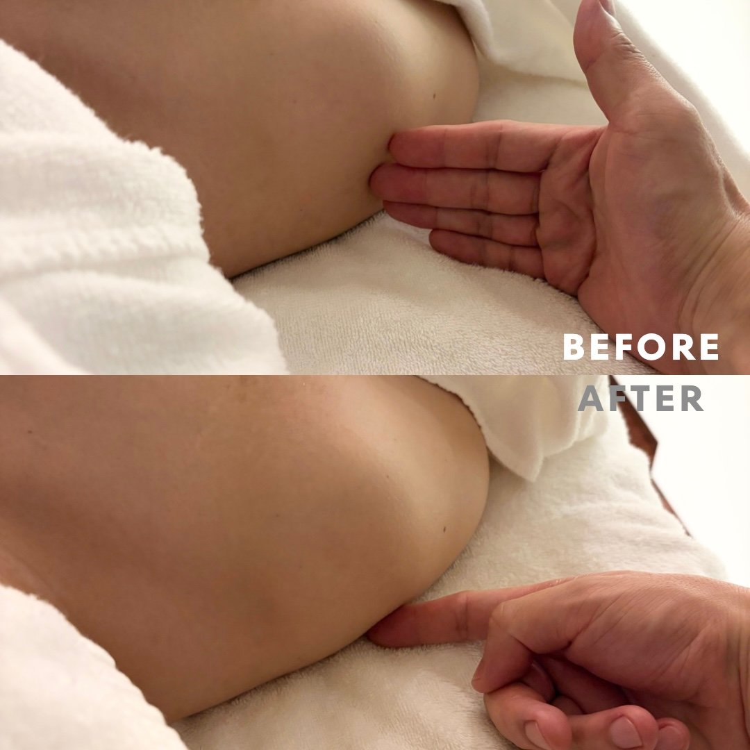 巻き肩リンパマッサージモニター④様