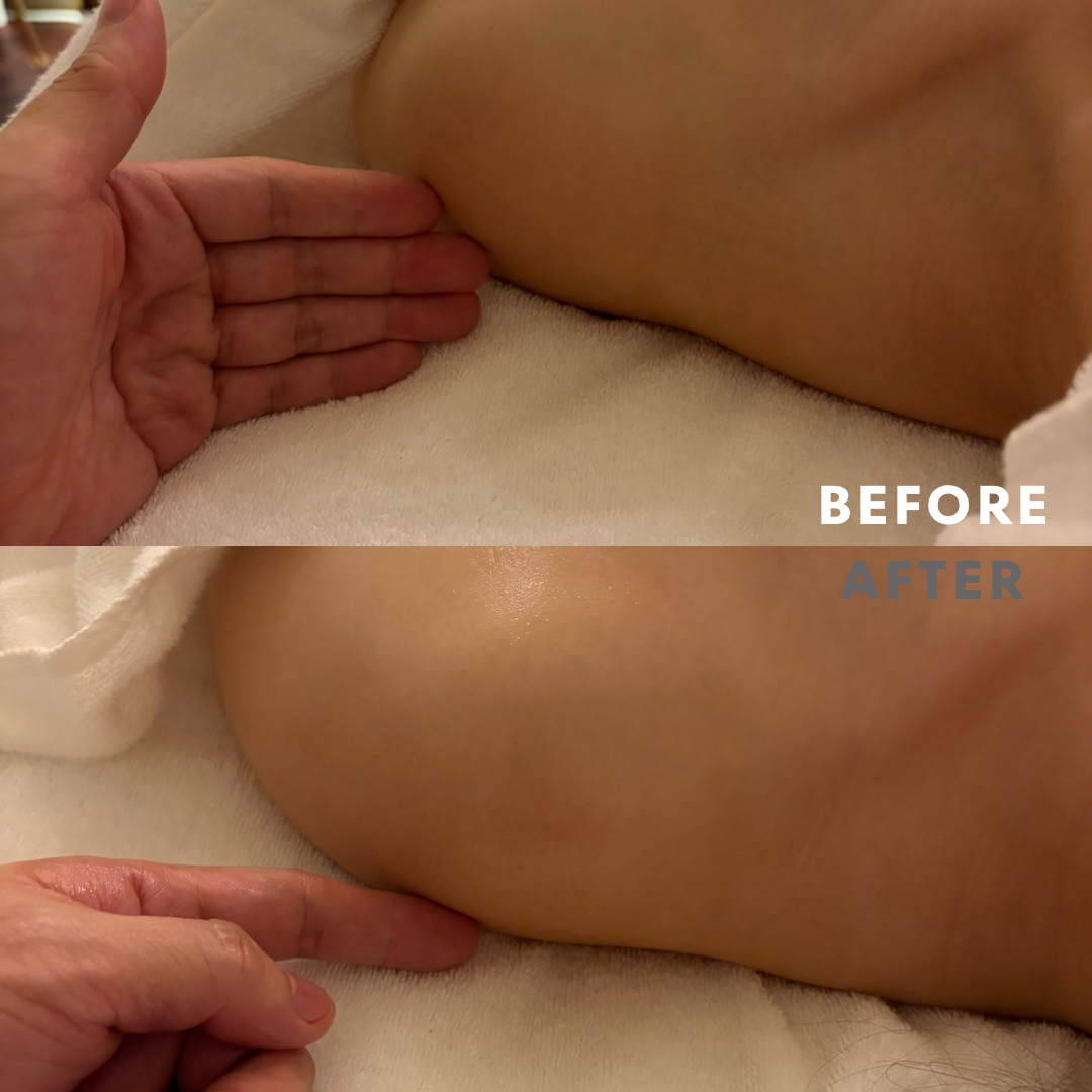 巻き肩リンパマッサージモニター②様