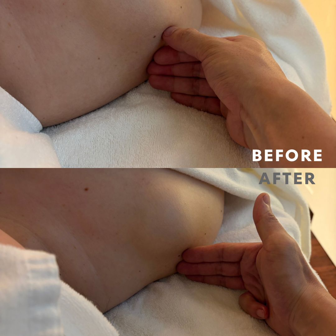 巻き肩リンパマッサージモニター⑥様