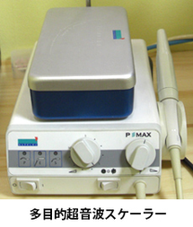 歯石取り(パワー調節可能超音波スケーラー)