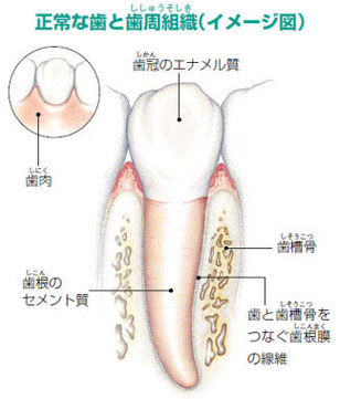 歯を支えている骨を再生(エムドゲイン法)