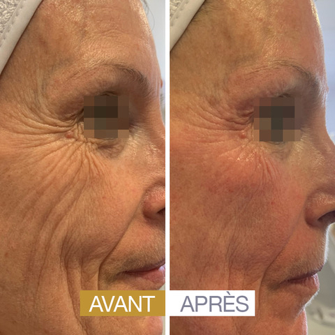 Soin visible âge reverse institut pin-up 