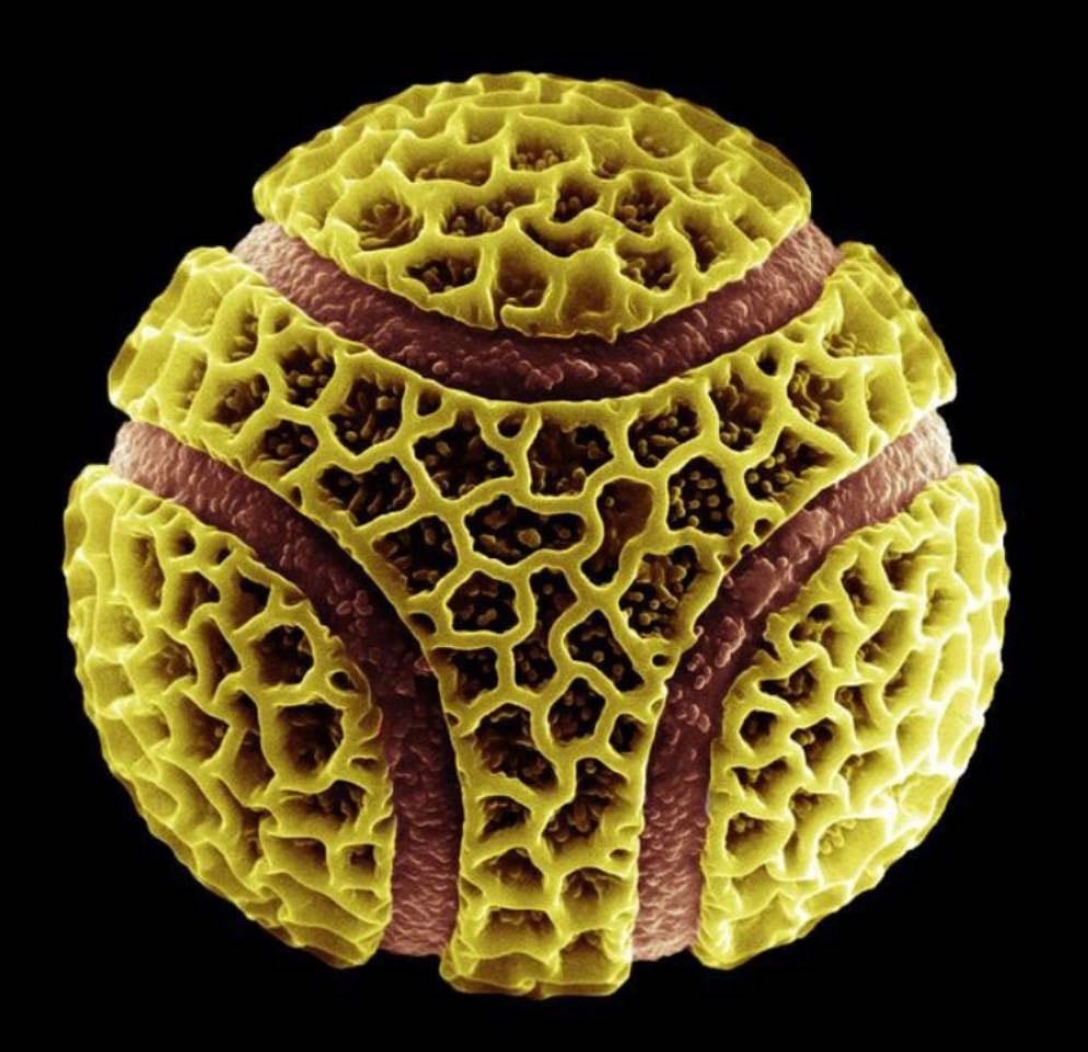 Aus dem Internet: Elektronenmirkoskop Bilder. Unser Liebling der Schokoladen Tennisball; Pollen der Passionsfrucht (Quelle Miniaturen der Natur)