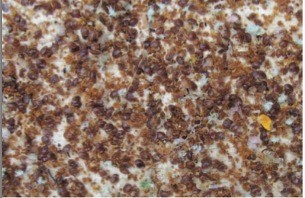 Behandlung mit Erfolg