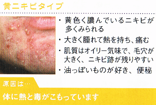 なりた安心堂薬局　黄色ニキビ　漢方相談