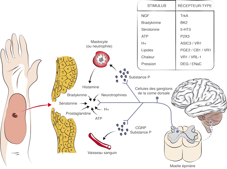 Hyperalgésie (a) et hyperalgésie secondaire (b)