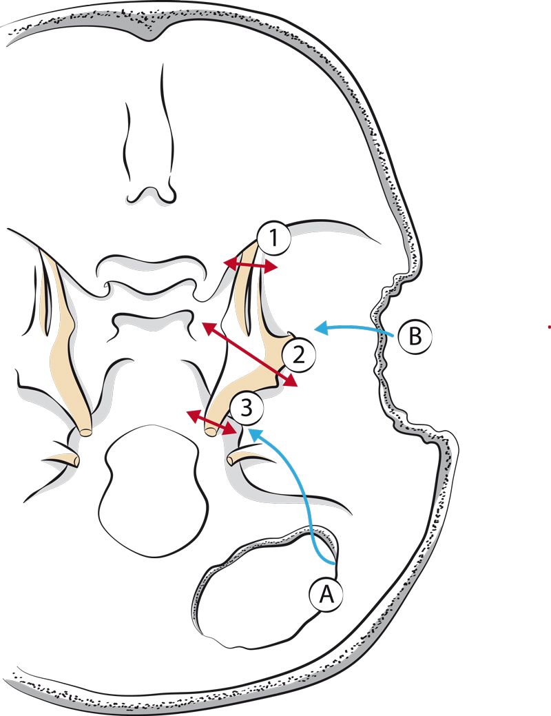 Voies d'abord du ganglion de Gasser