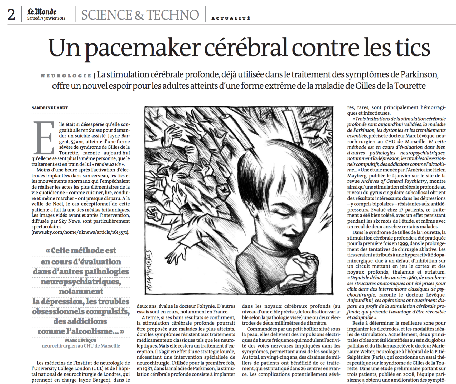 Le Monde - Un pacemaker cérébral contre les tics - 07/01/12 