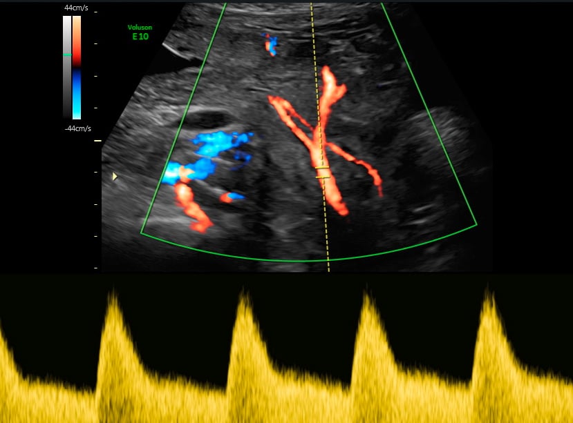 Dopplersymposium Salzburg / München