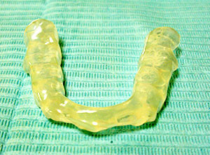 精密マウスピース