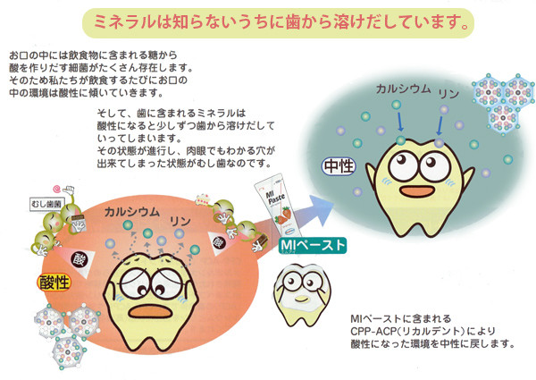 ＭＩペースト２