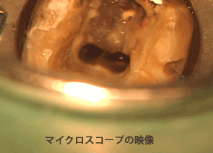 マイクロスコープの映像
