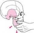 Hippocratic method for reducing temporomandibular joint dislocation 