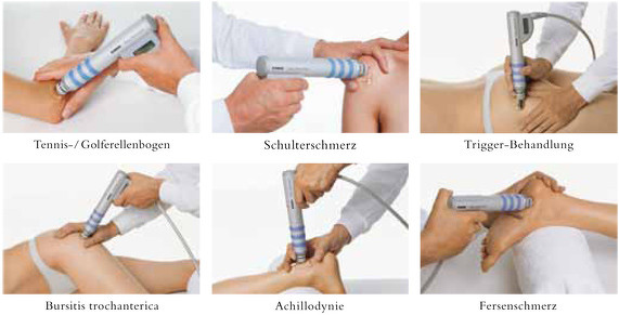 Der Orthopäde Dr. Steven Moayad bietet in seiner Ordination in Wien die Stoßwellentherapie an.