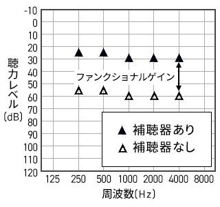 装用閾値測定。まず補聴器をつけていない状態での聞こえを測定します。音がかすかでも聞こえた時に応答ボタンを押して頂きます。結果は△で表示します。この△が下にあるほど、聞きにくいということを表しています。次に補聴器を着けて同様の測定を行います。結果は▲で表示します。表は縦軸が聴力レベル、横軸が周波数です。この表で見ますと、1000Hzでは補聴器なしで60dBの大きさで聞こえていたのが、補聴器ありでは30dBの大きさでも聞こえるよう改善しています。この差30dBをファンクショナルゲインと言い、補聴器の効果を表し