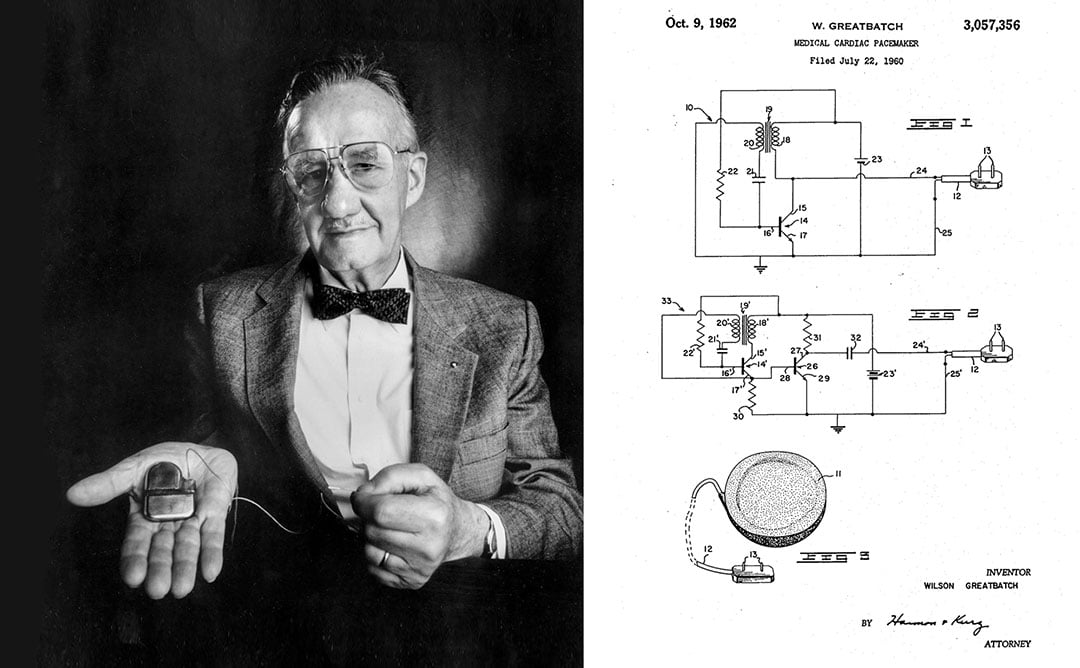 Подих життя. Історія винаходу кардіостимулятора