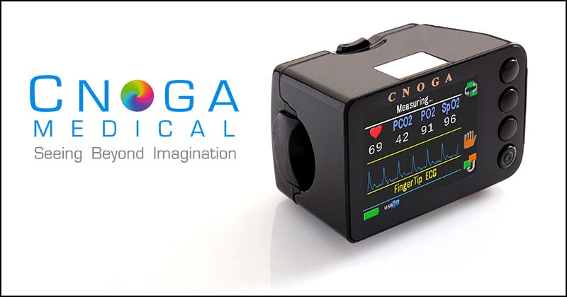 TensorTip - перший неінвазивний глюкометр