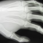 保存療法　国分寺こみね鍼灸整骨院