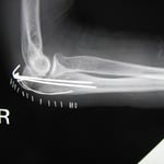 国分寺こみね鍼灸整骨院